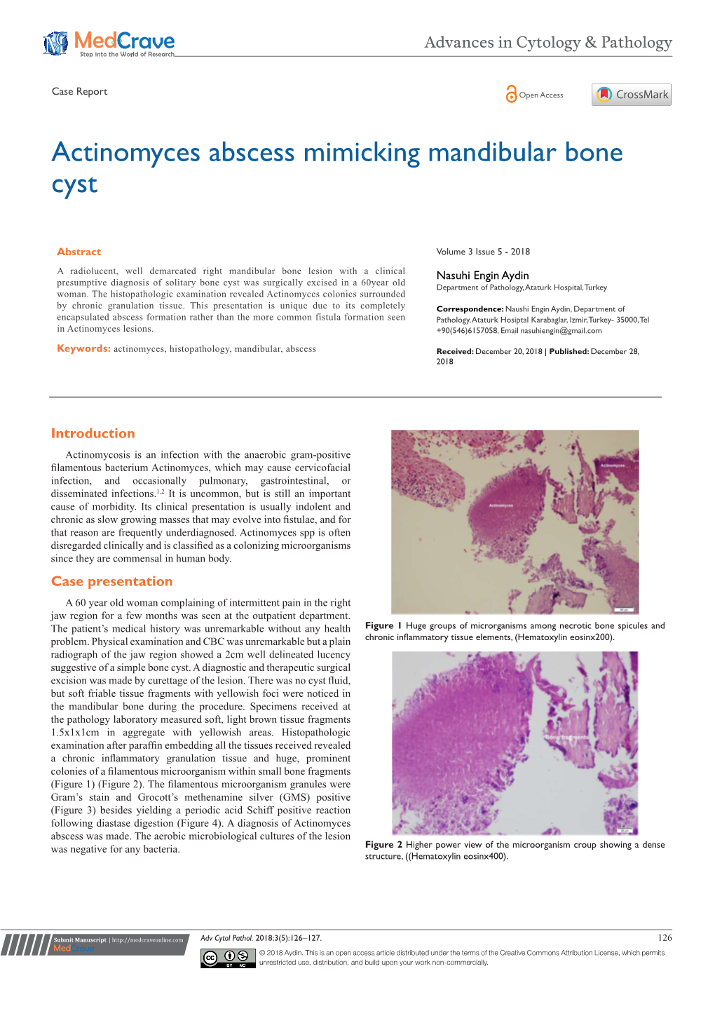 Actinomyces Abscess Mimicking Mandibular Bone Cyst