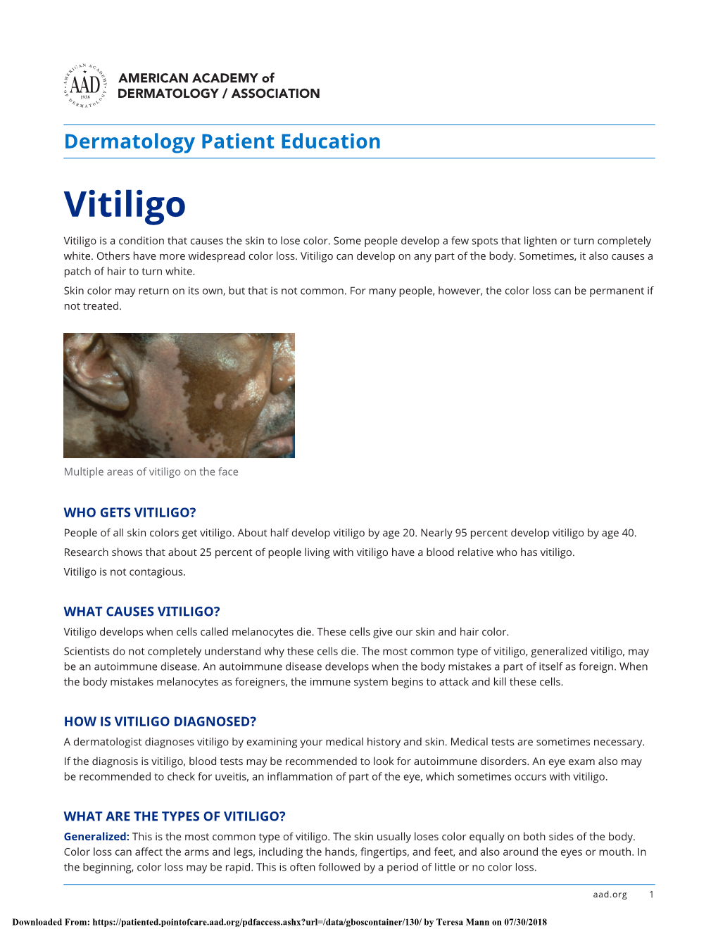 Vitiligo Vitiligo Is a Condition That Causes the Skin to Lose Color