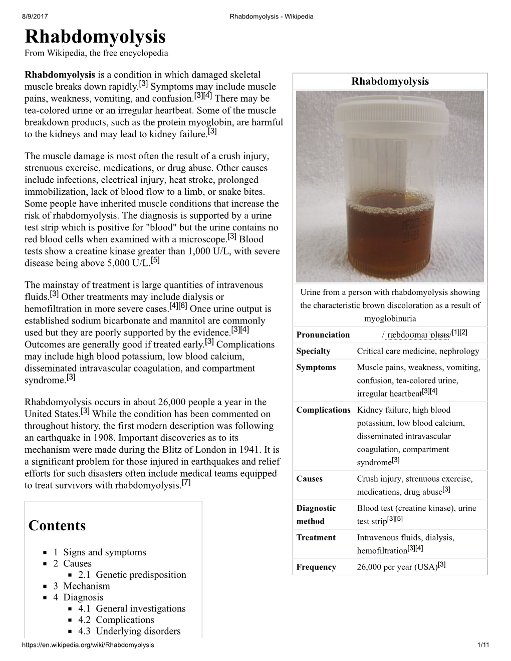 Rhabdomyolysis - Wikipedia Rhabdomyolysis from Wikipedia, the Free Encyclopedia