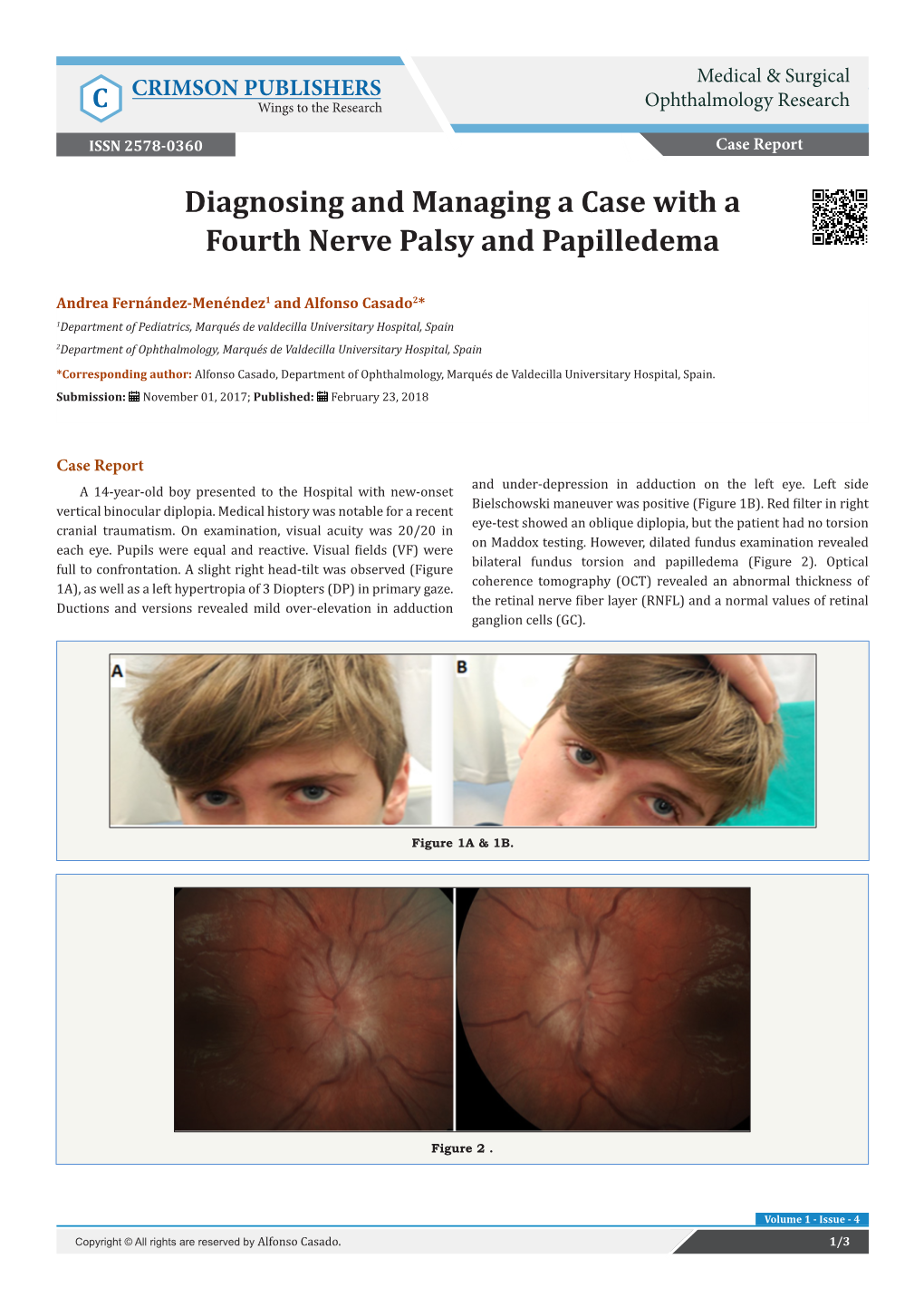 Diagnosing and Managing a Case with a Fourth Nerve Palsy and Papilledema