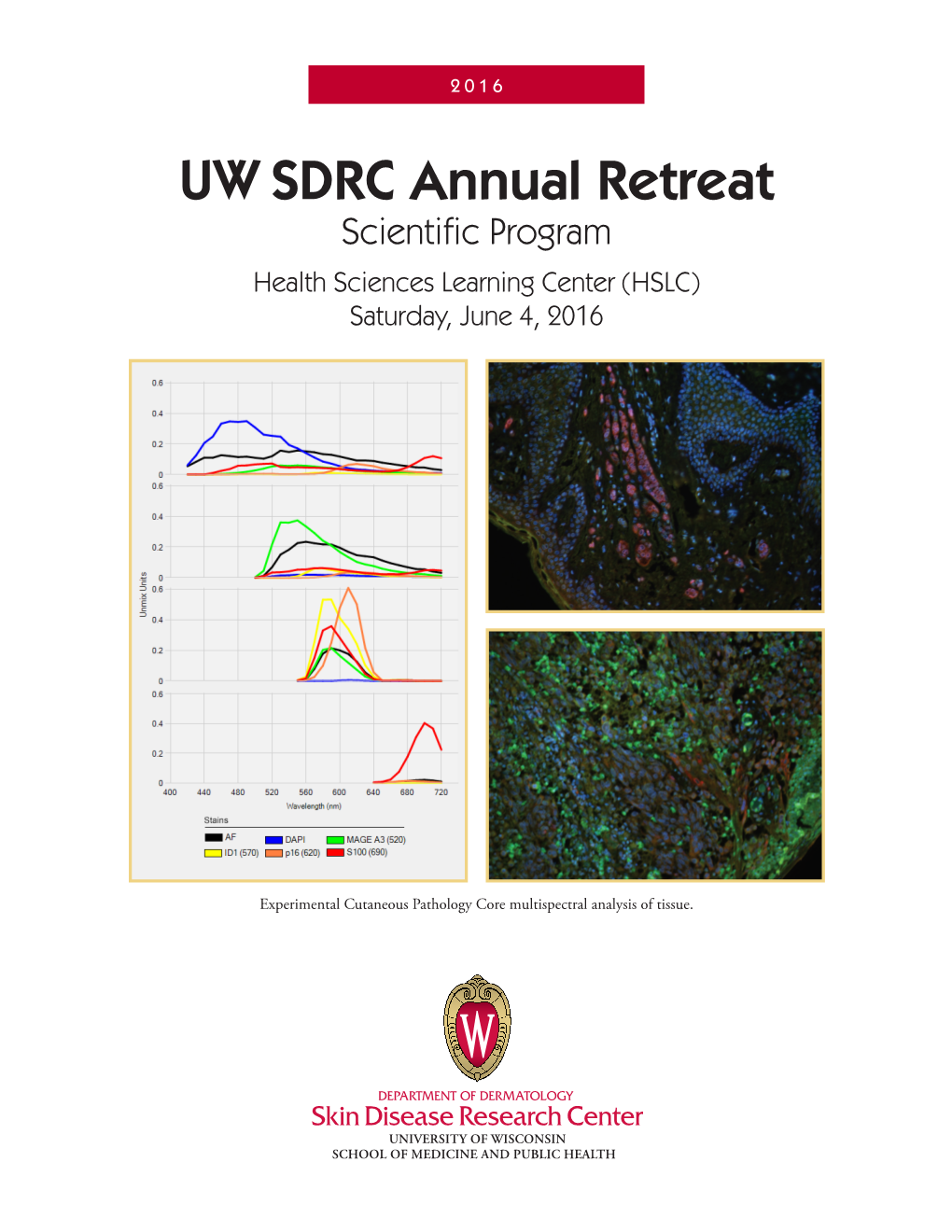 UW SDRC Annual Retreat Scientific Program Health Sciences Learning Center (HSLC) Saturday, June 4, 2016