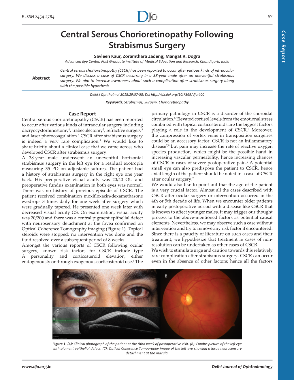 Central Serous Chorioretinopathy Following Strabismus Surgery