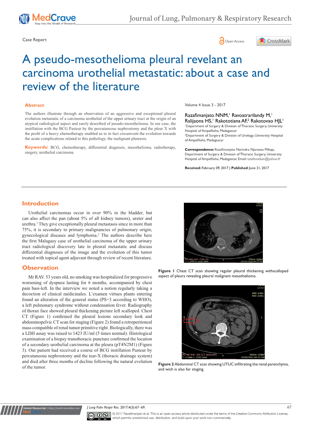 A Pseudo-Mesothelioma Pleural Revelant an Carcinoma Urothelial Metastatic: About a Case and Review of the Literature