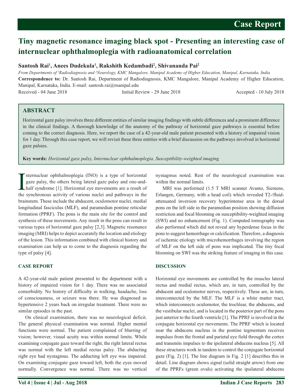 Presenting an Interesting Case of Internuclear Ophthalmoplegia with Radioanatomical Correlation