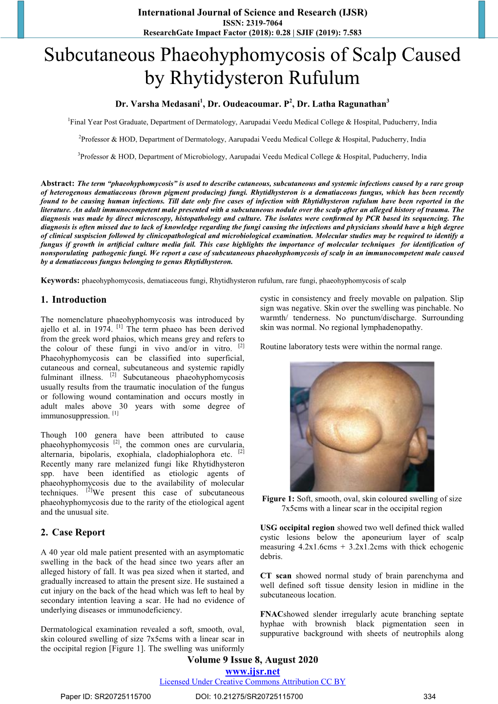 Subcutaneous Phaeohyphomycosis of Scalp Caused by Rhytidysteron Rufulum