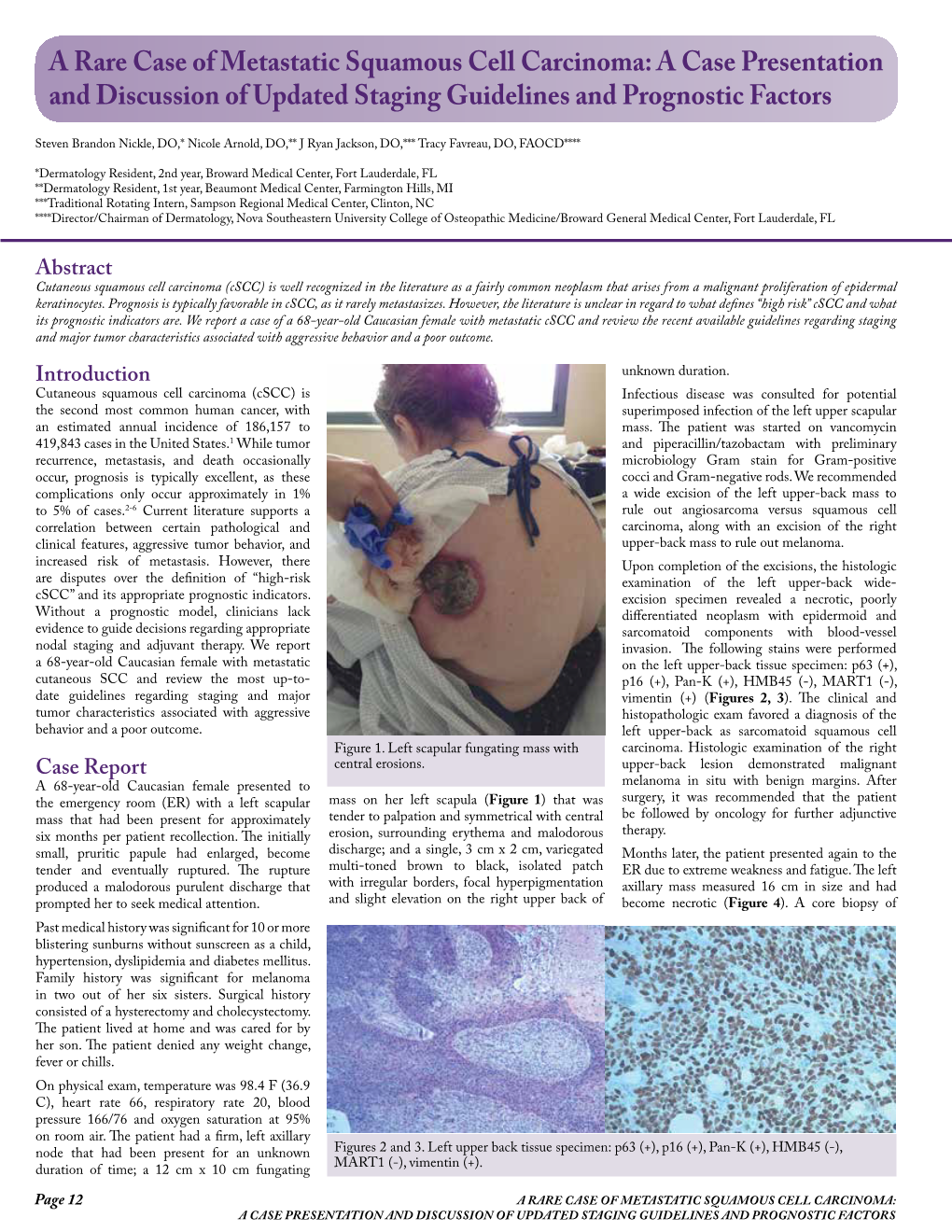 A Rare Case of Metastatic Squamous Cell Carcinoma: a Case Presentation and Discussion of Updated Staging Guidelines and Prognostic Factors