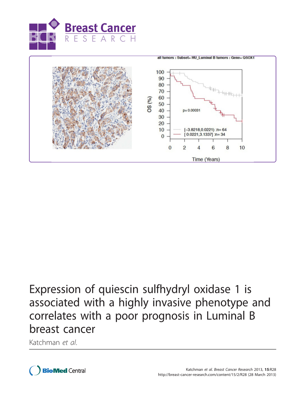 Expression of Quiescin Sulfhydryl Oxidase 1 Is Associated with a Highly Invasive Phenotype and Correlates with a Poor Prognosis