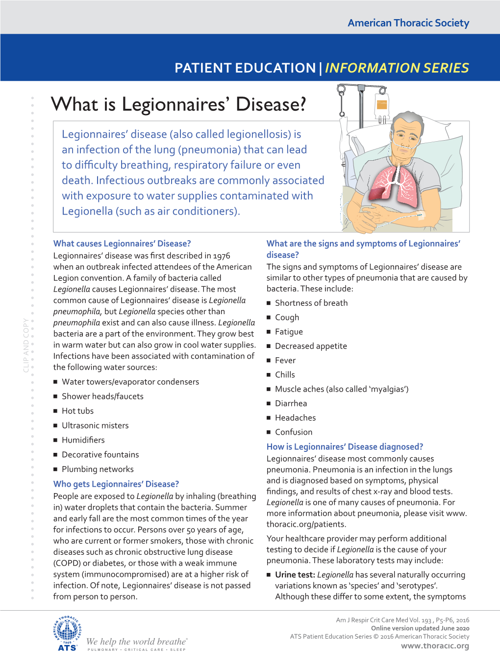 What Is Legionnaires' Disease?