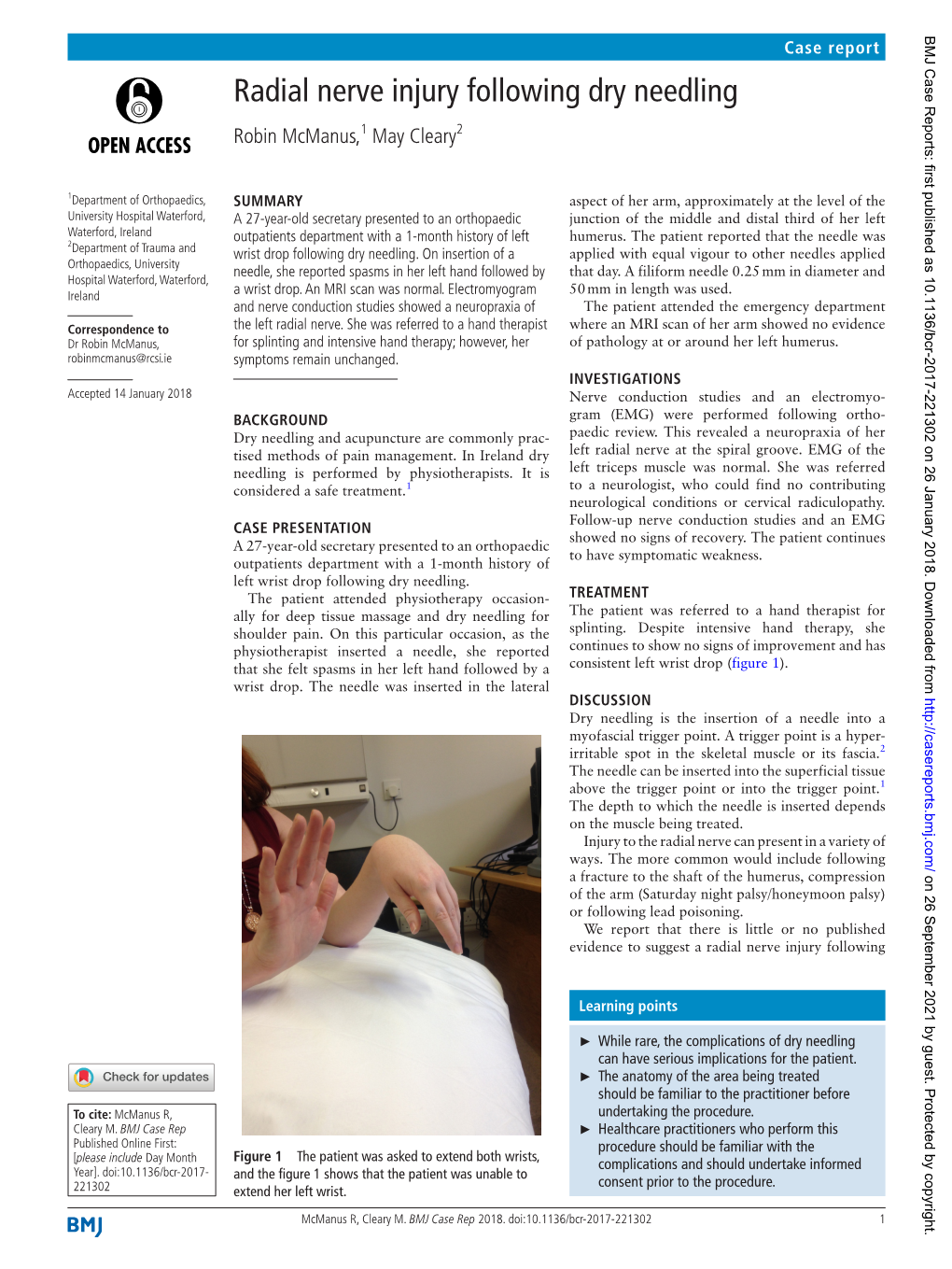 Radial Nerve Injury Following Dry Needling Robin Mcmanus,1 May Cleary2