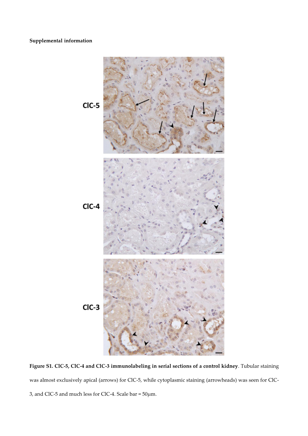 Supplemental Information Figure S1. Clc-5, Clc-4 and Clc-3