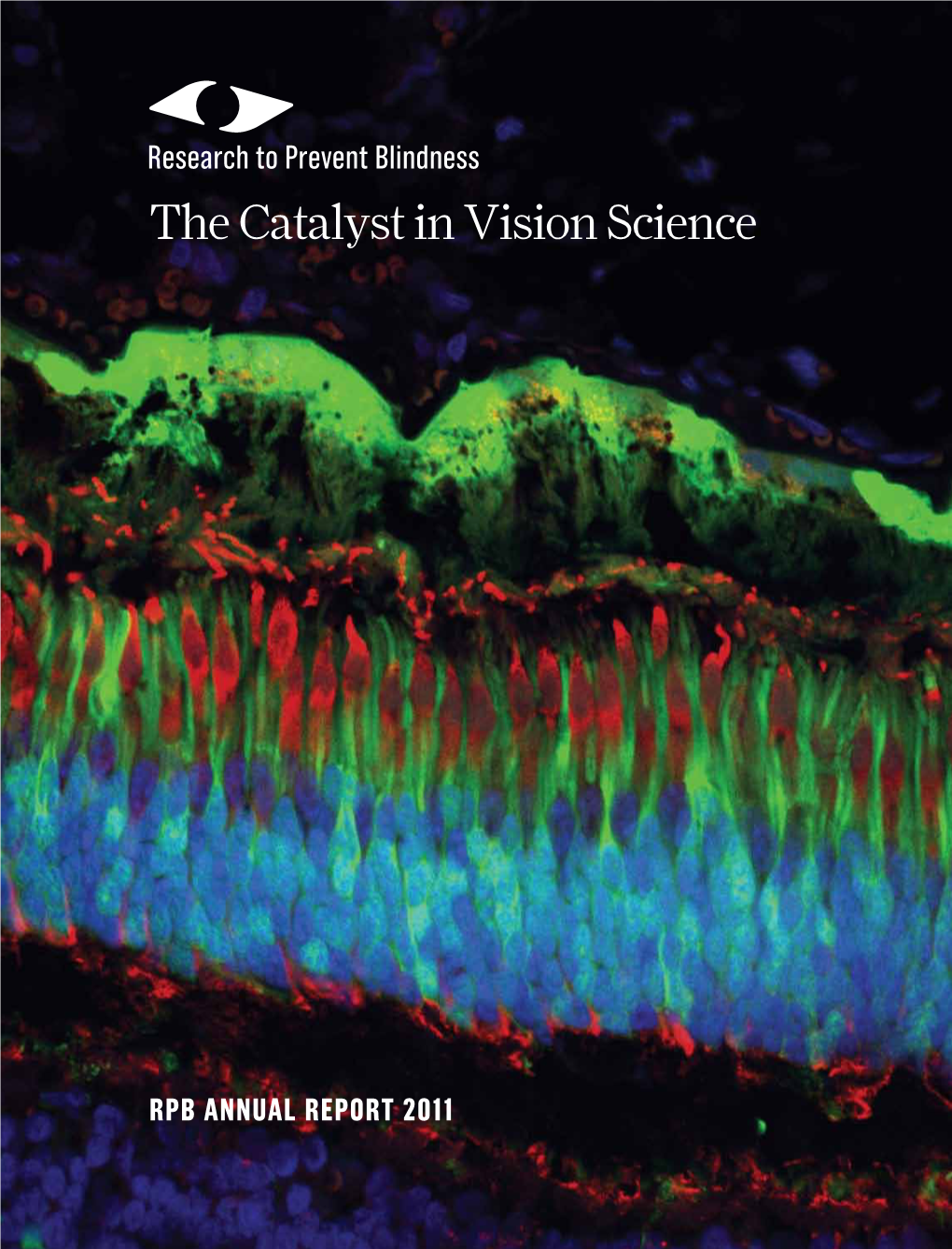 The Catalyst in Vision Science