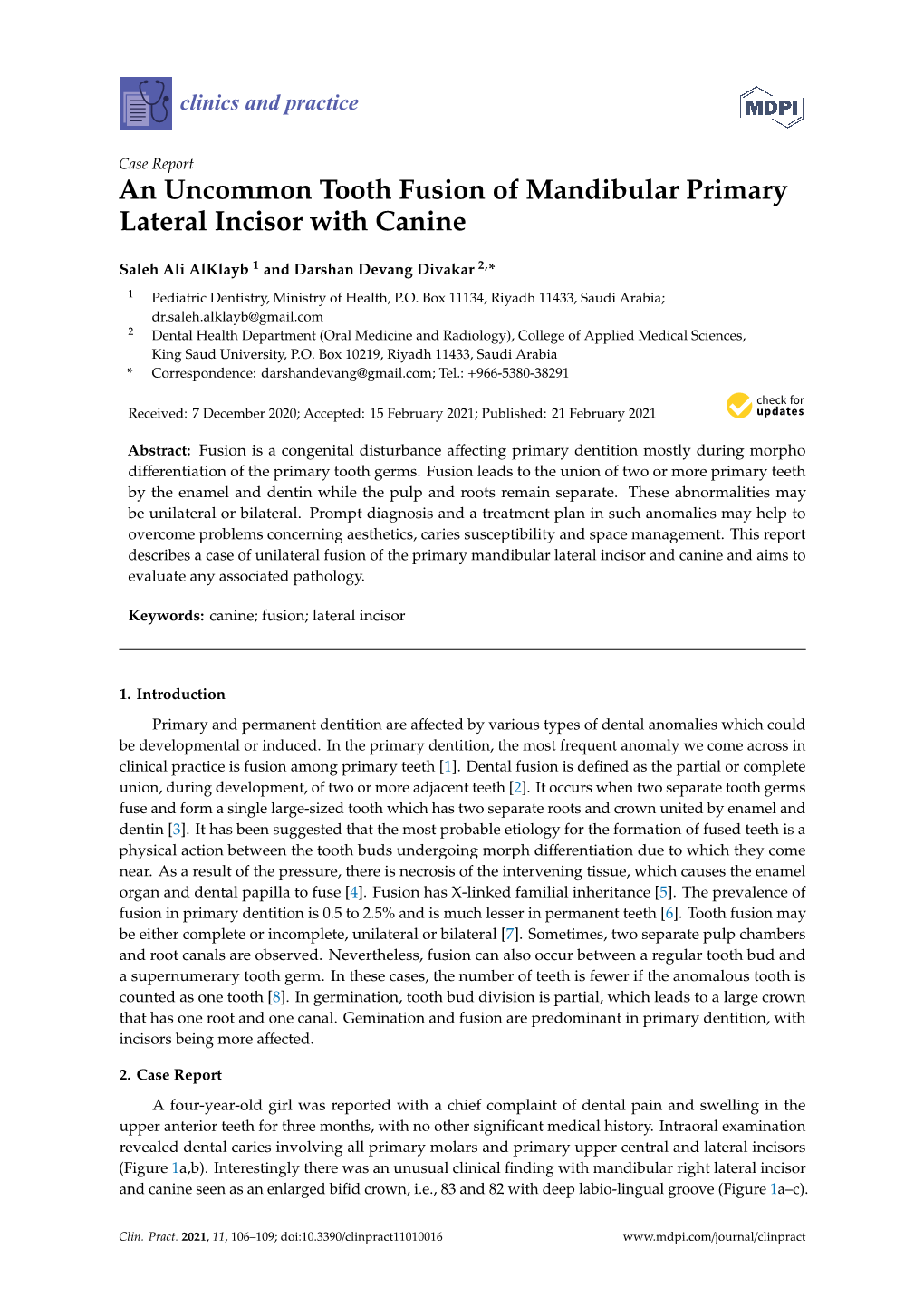 An Uncommon Tooth Fusion of Mandibular Primary Lateral Incisor with Canine