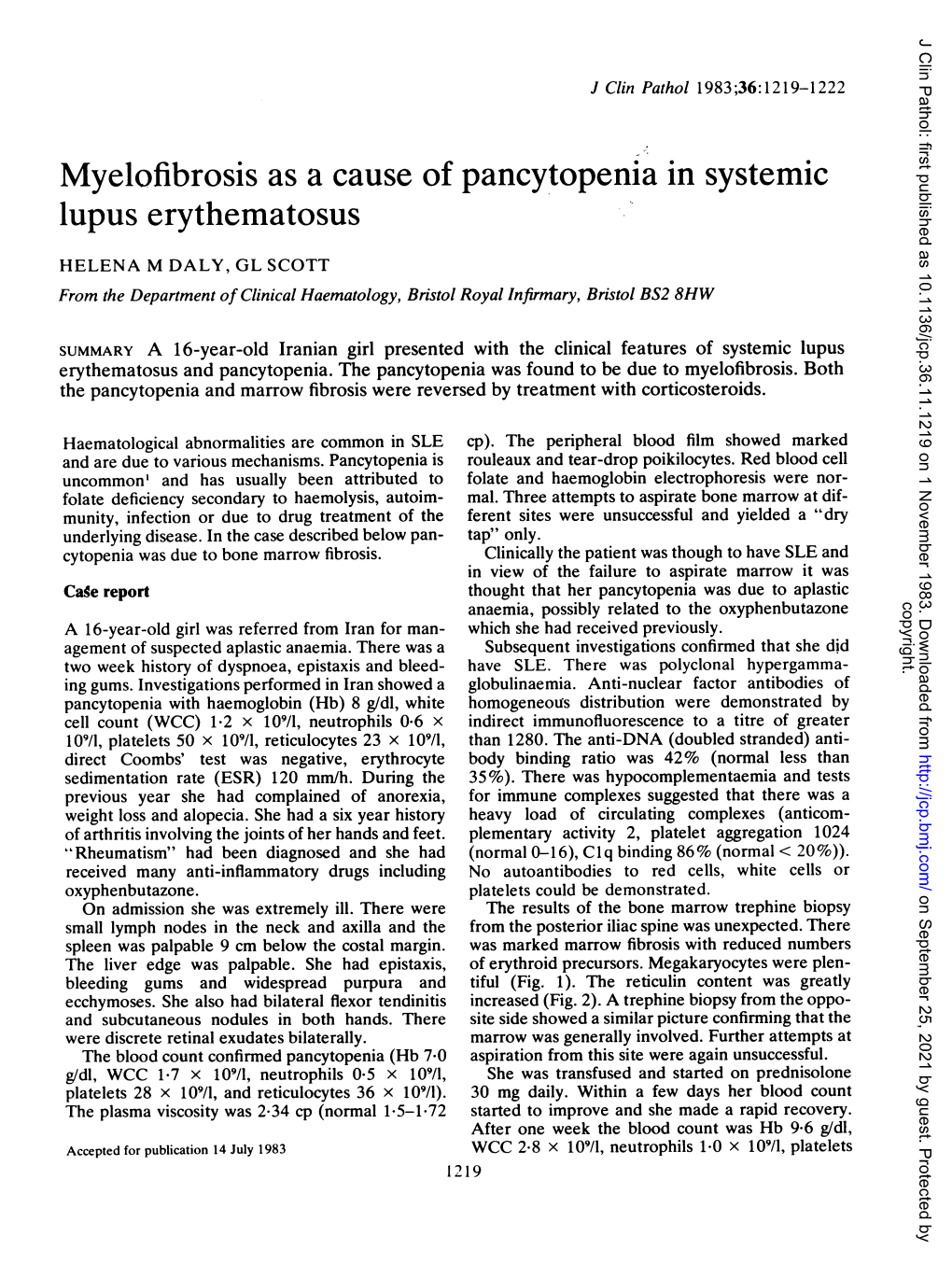 Lupus Erythematosus