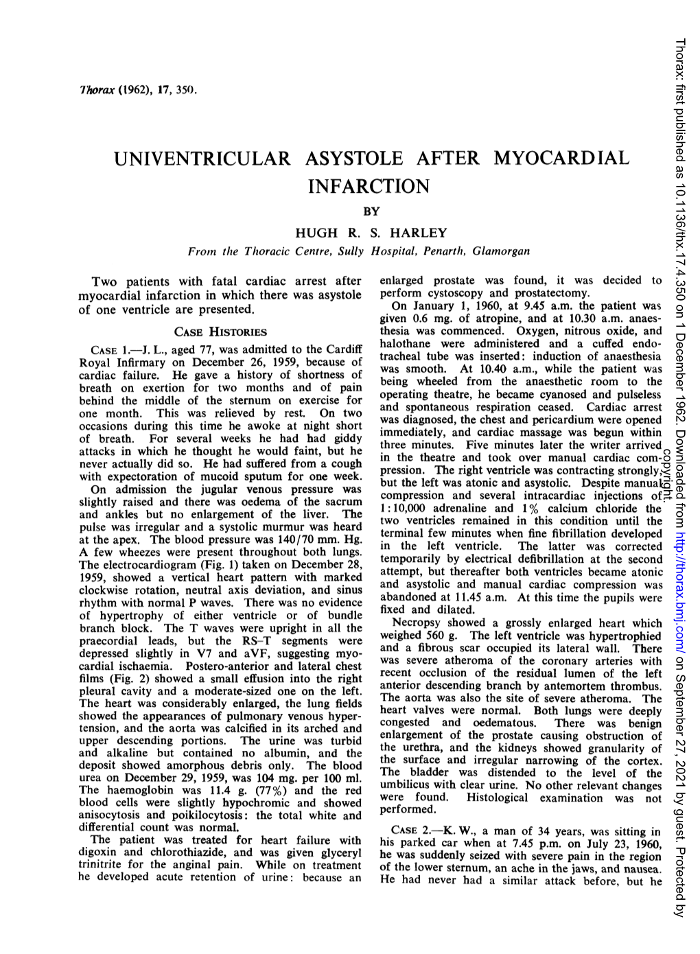 Univentricular Asystole After Myocardial Infarction by Hugh R