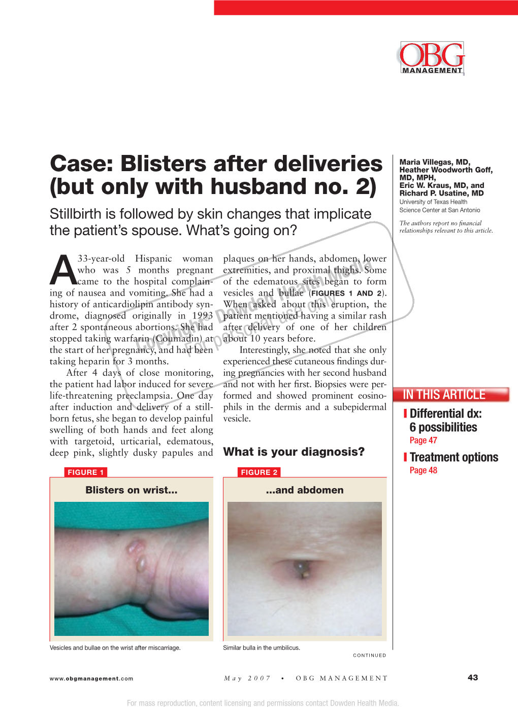 Blisters After Deliveries Heather Woodworth Goff, MD, MPH, Eric W