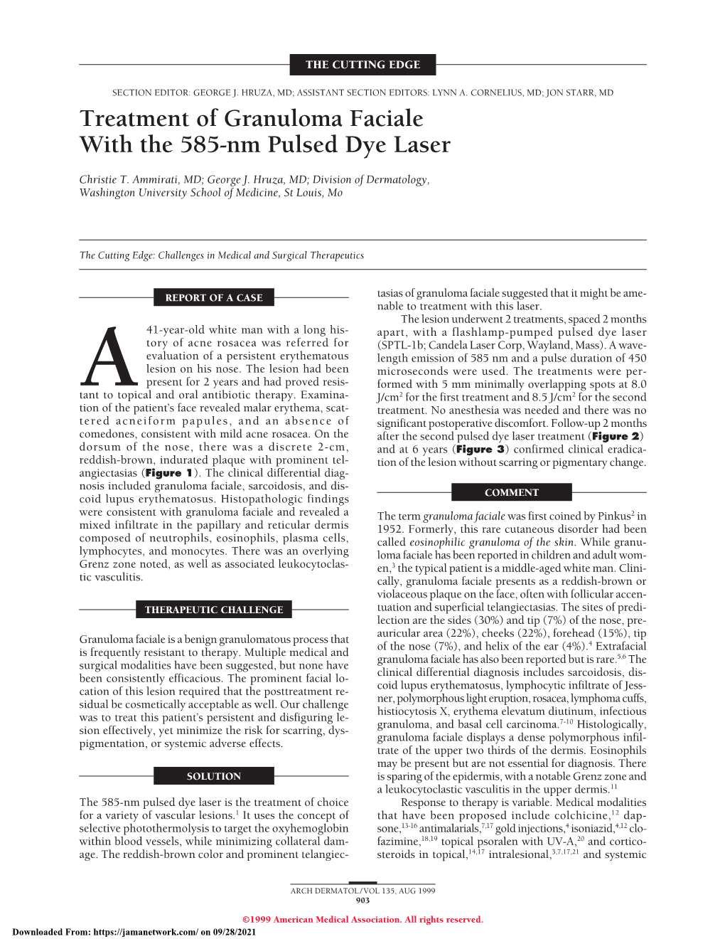 Treatment of Granuloma Faciale with the 585-Nm Pulsed Dye Laser