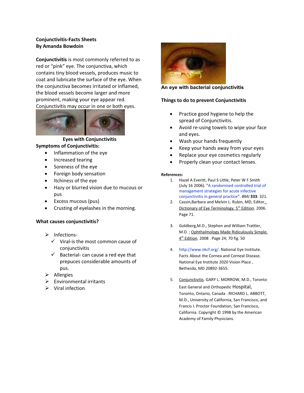 Conjunctivitis-Facts Sheets