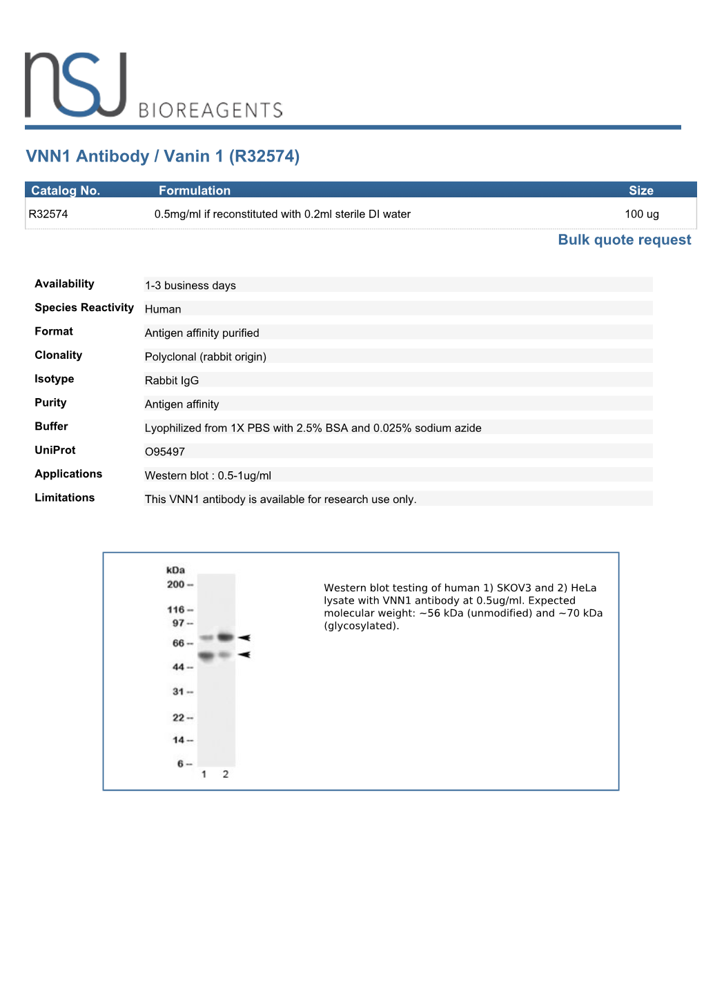 VNN1 Antibody / Vanin 1 (R32574)