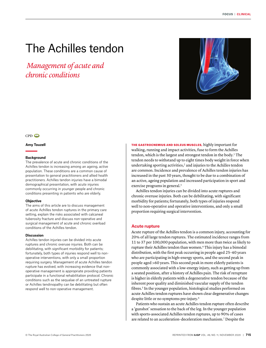 The Achilles Tendon