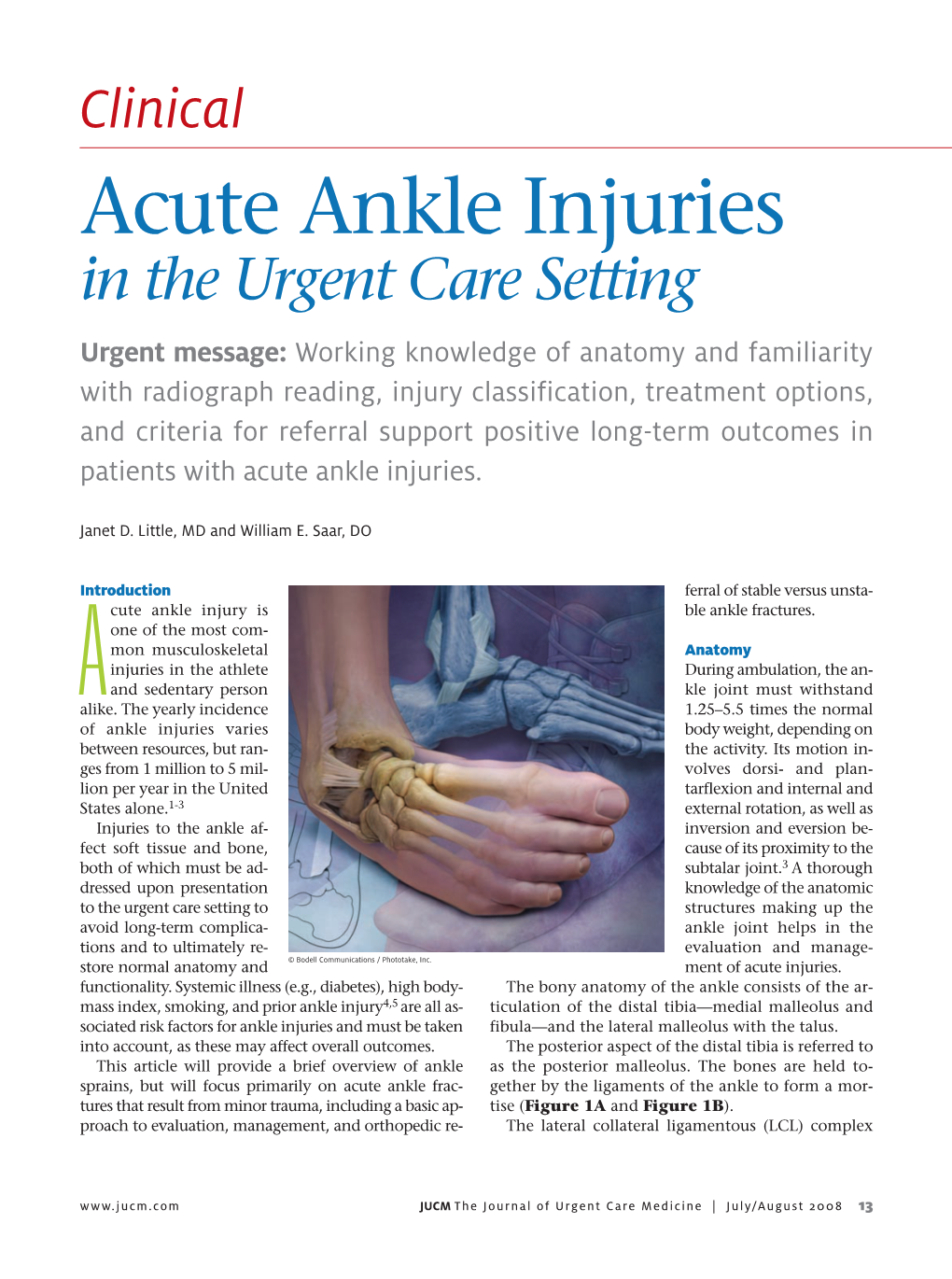 Acute Ankle Injuries