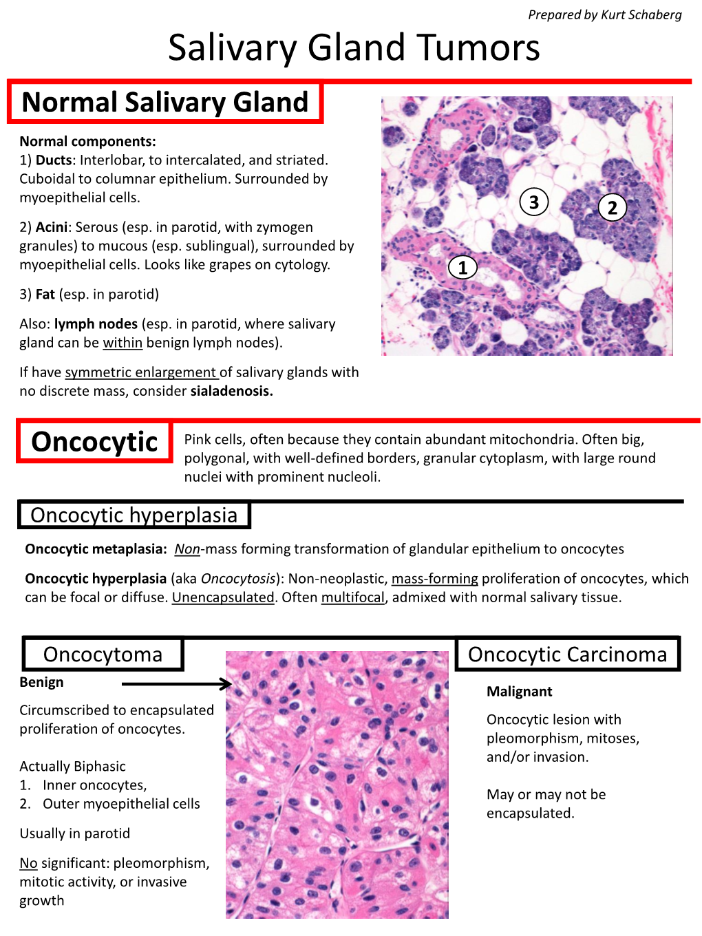 Salivary Gland Tumors Normal Salivary Gland Normal Components: 1) Ducts: Interlobar, to Intercalated, and Striated