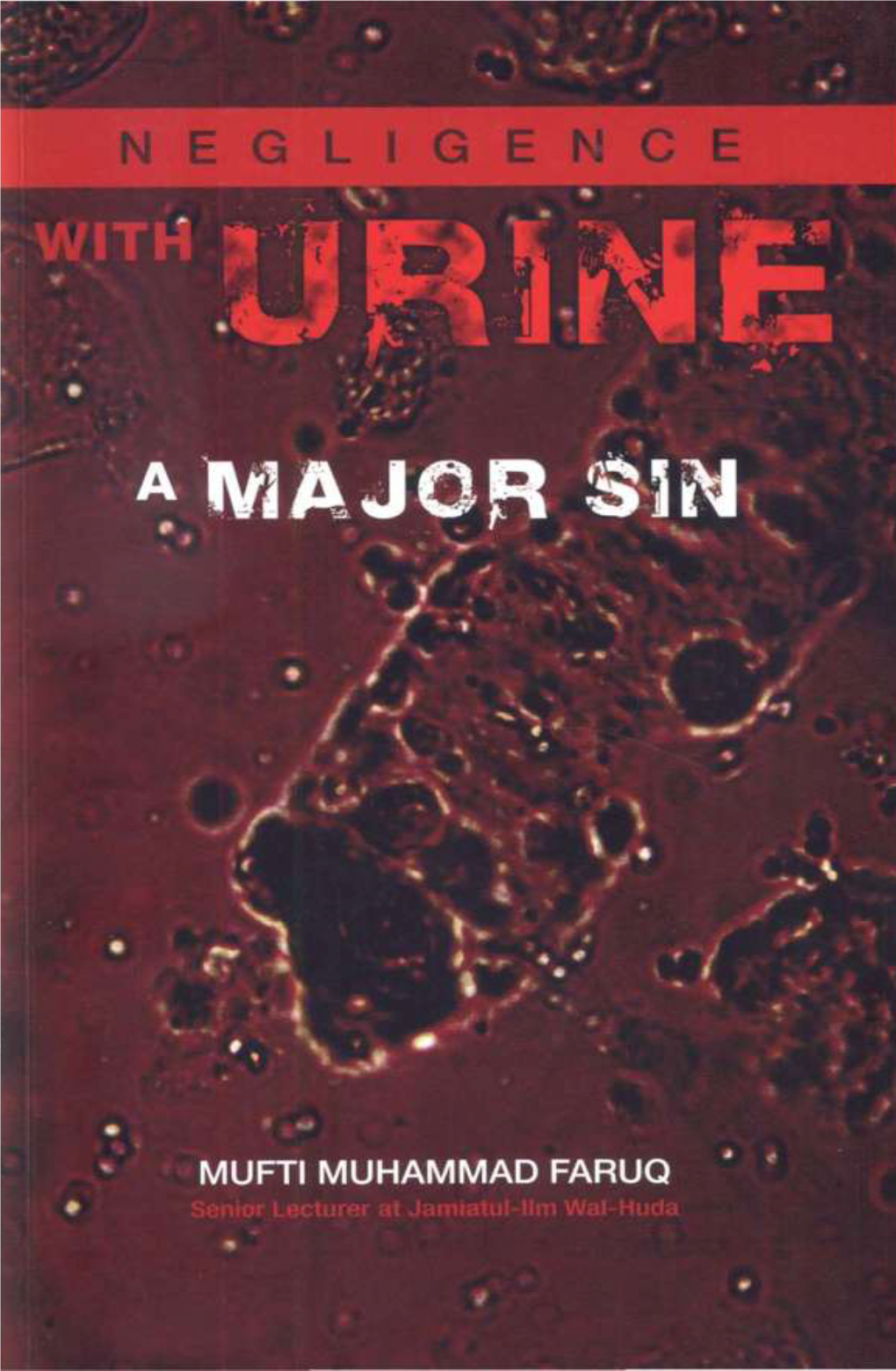 Negligence with Urine a Major
