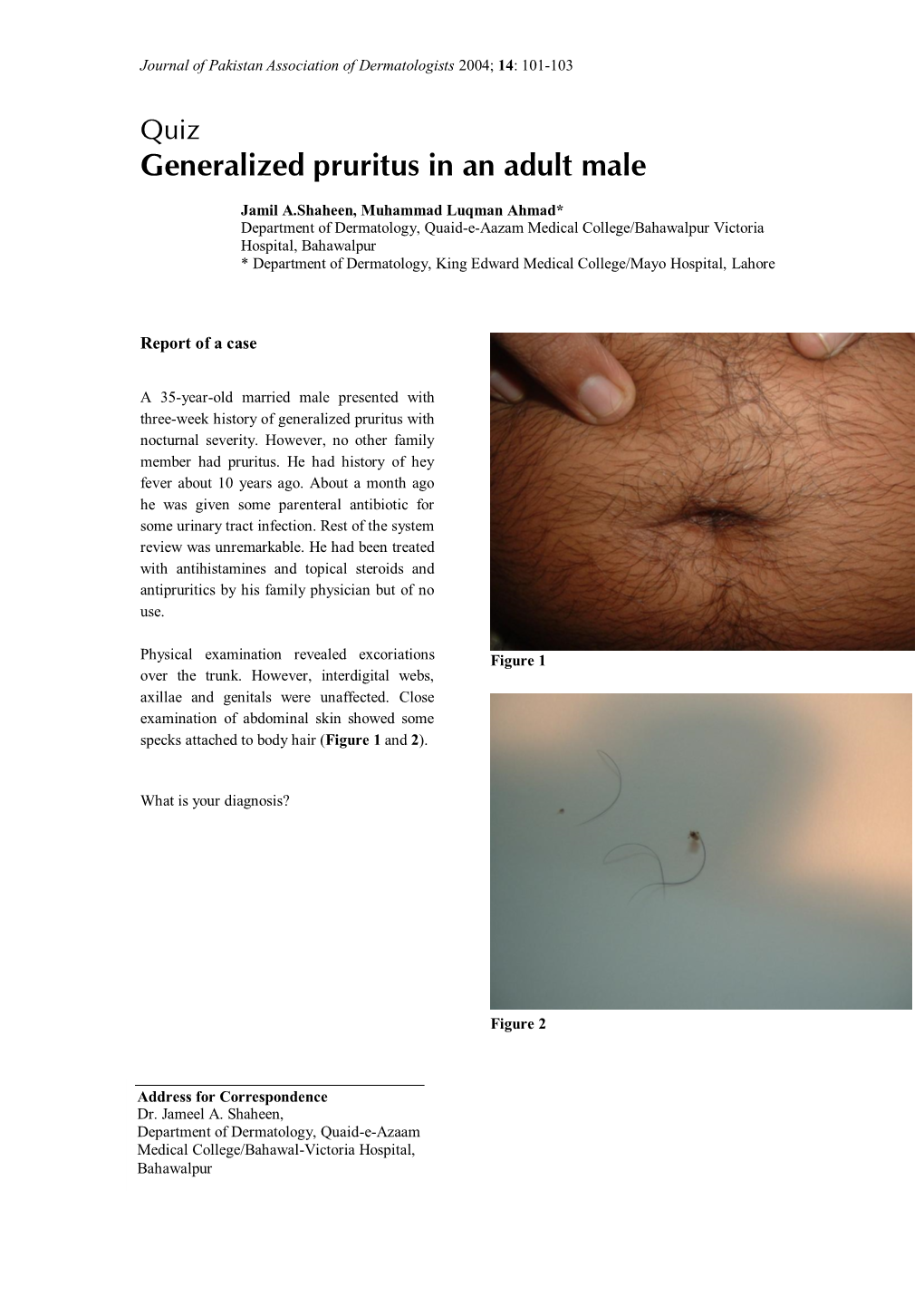 Generalized Pruritus in an Adult Male