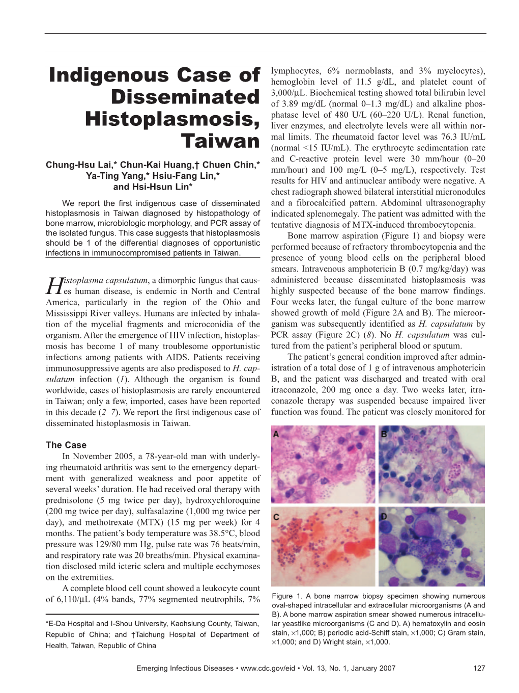 Indigenous Case of Disseminated Histoplasmosis, Taiwan