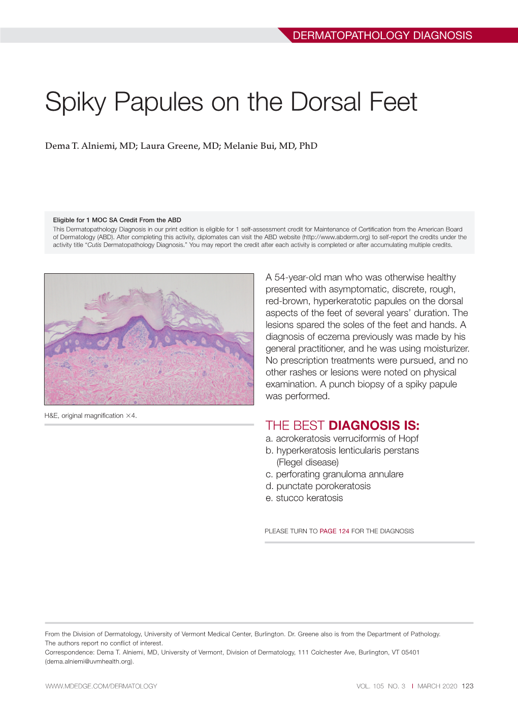 Spiky Papules on the Dorsal Feet