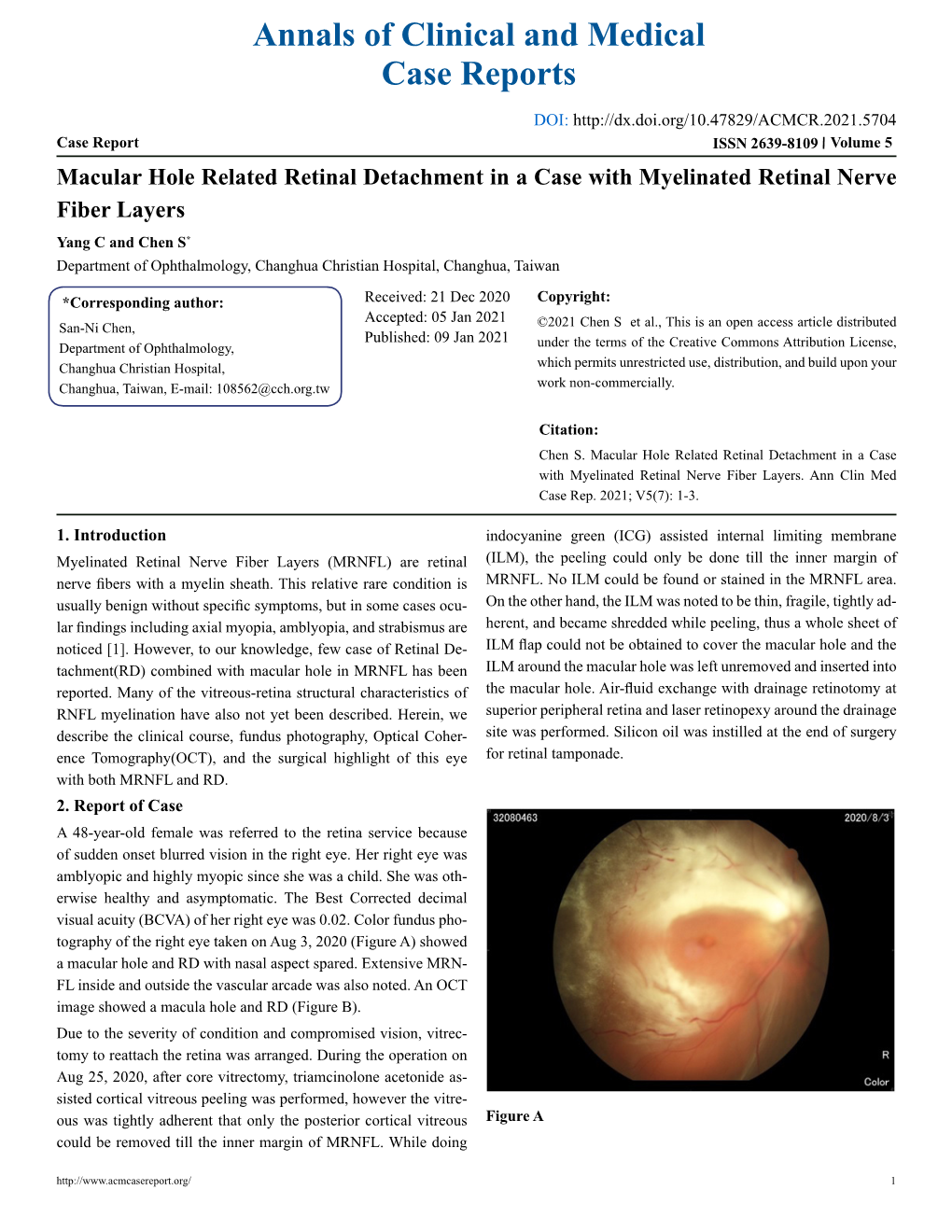 Macular Hole Related Retinal Detachment in a Case With
