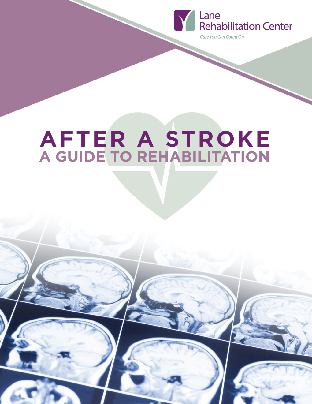 Stroke Rehabilitation Guide