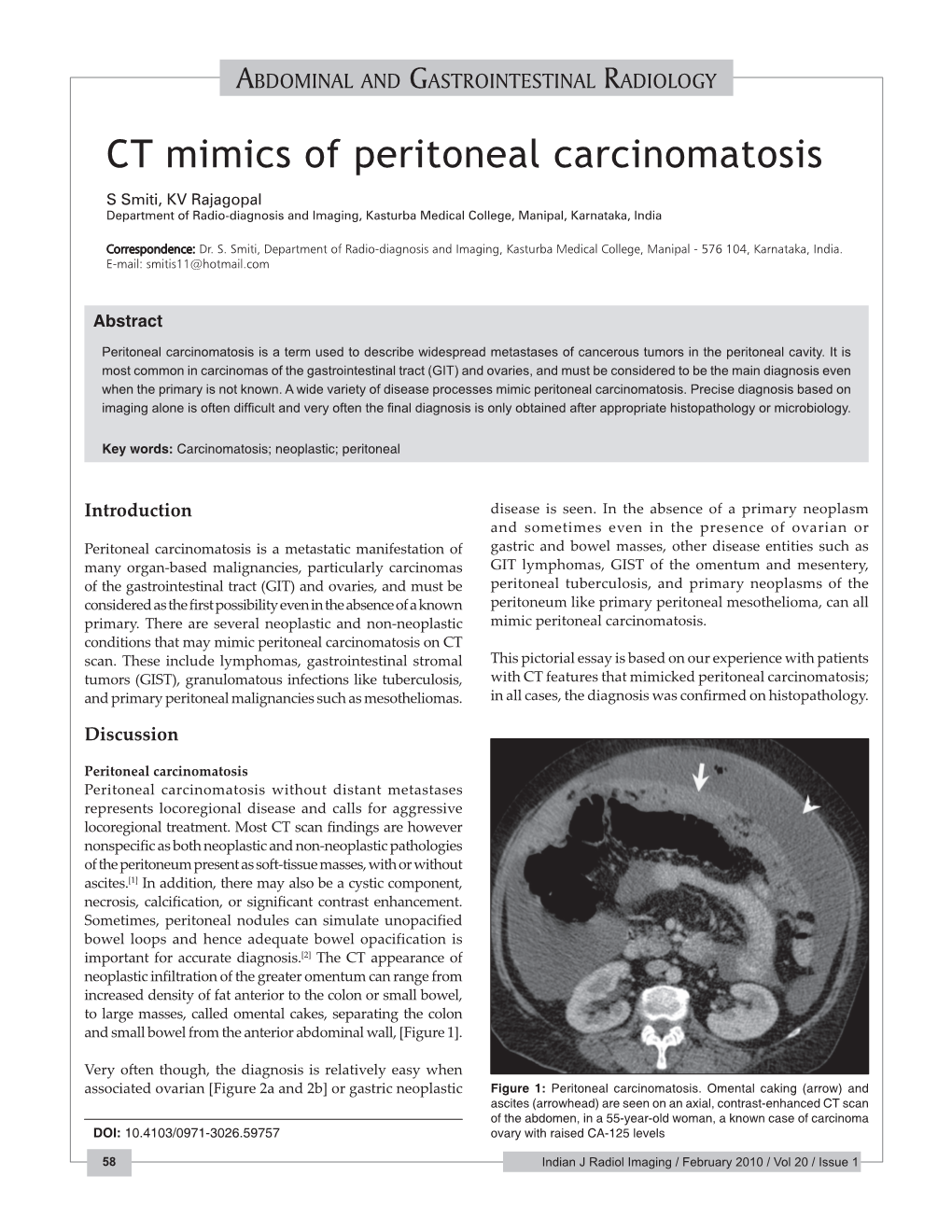 CT Mimics of Peritoneal Carcinomatosis