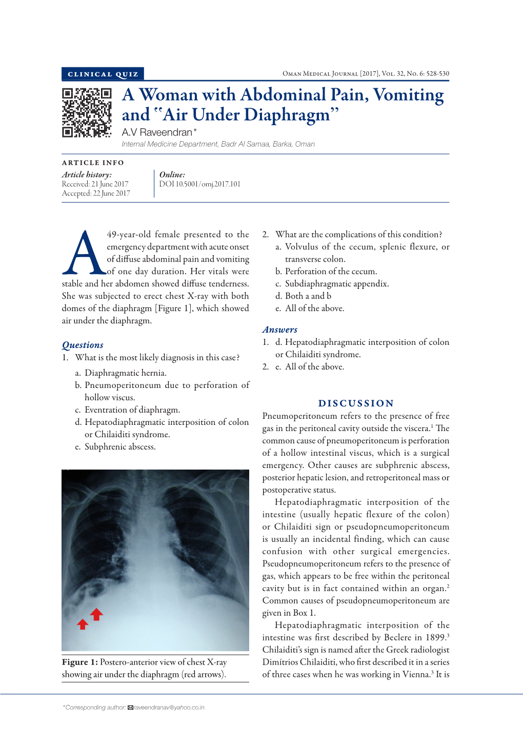 A Woman with Abdominal Pain, Vomiting and ‟Air Under Diaphragm” A.V Raveendran* Internal Medicine Department, Badr Al Samaa, Barka, Oman