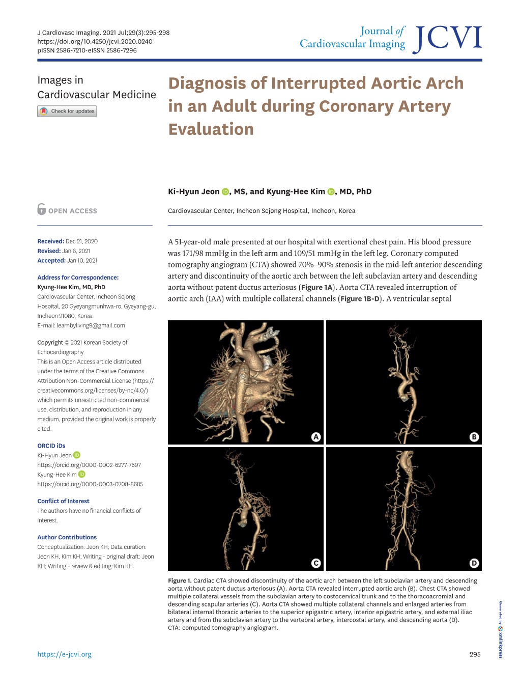 Diagnosis of Interrupted Aortic Arch in an Adult During Coronary Artery