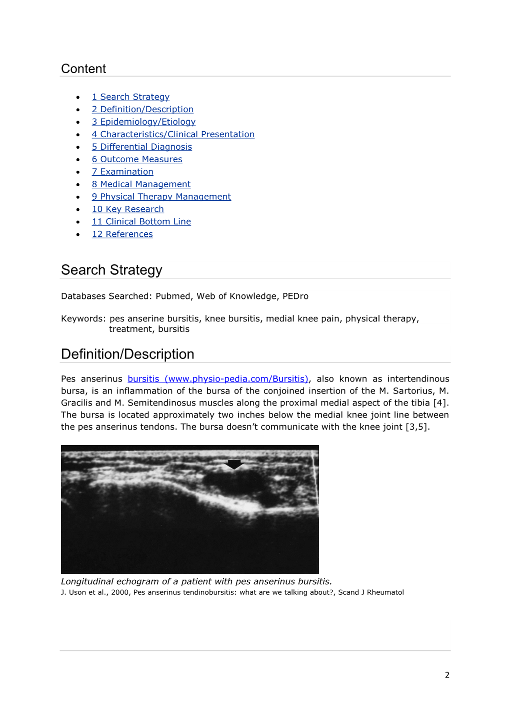 Pes Anserinus Bursitis ( Also Known As Intertendinous Bursa, Is an Inflammation of the Bursa of the Conjoined Insertion of the M