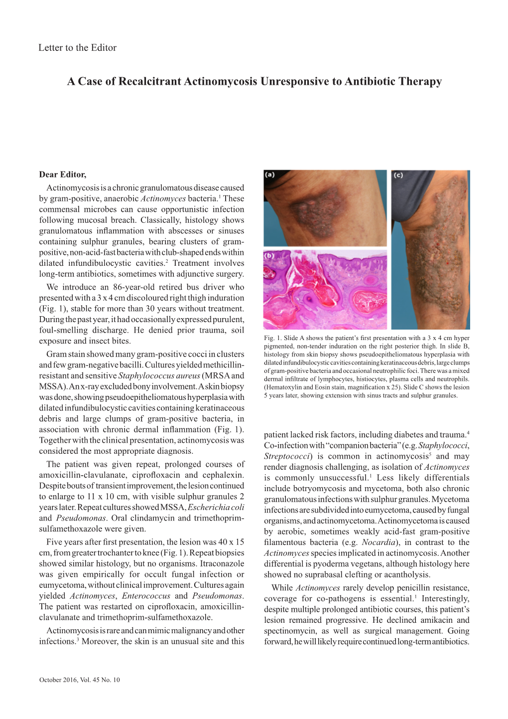 A Case of Recalcitrant Actinomycosis Unresponsive to Antibiotic Therapy