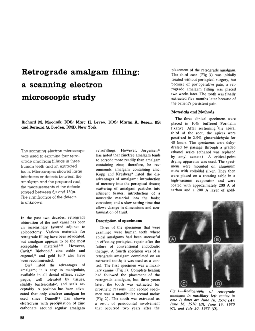 Retrograde Amalgam Filling