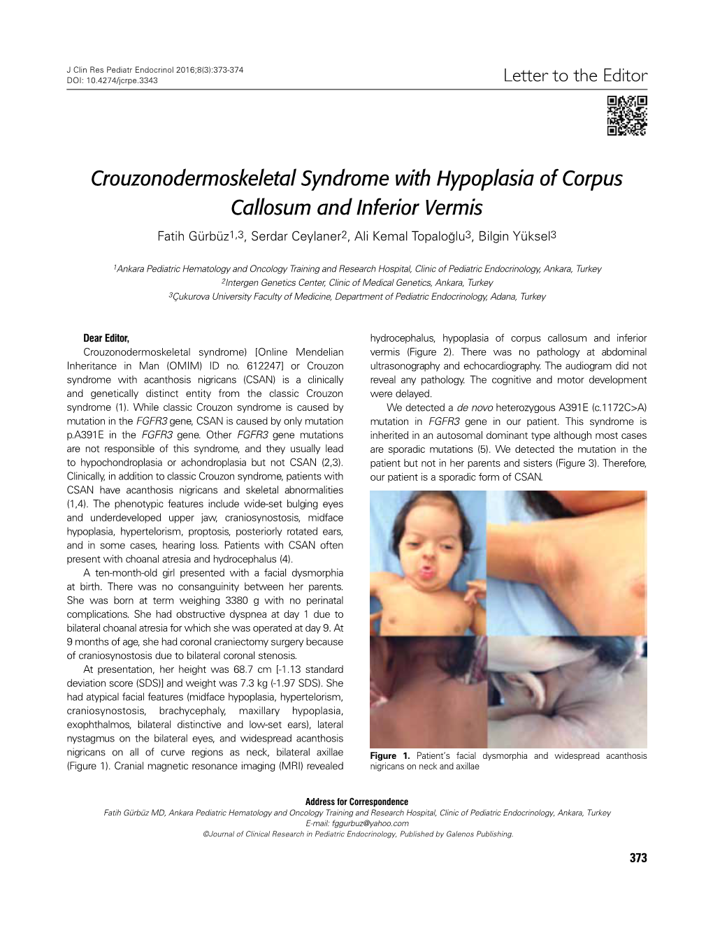 Crouzonodermoskeletal Syndrome with Hypoplasia of Corpus Callosum and Inferior Vermis Fatih Gürbüz1,3, Serdar Ceylaner2, Ali Kemal Topaloğlu3, Bilgin Yüksel3