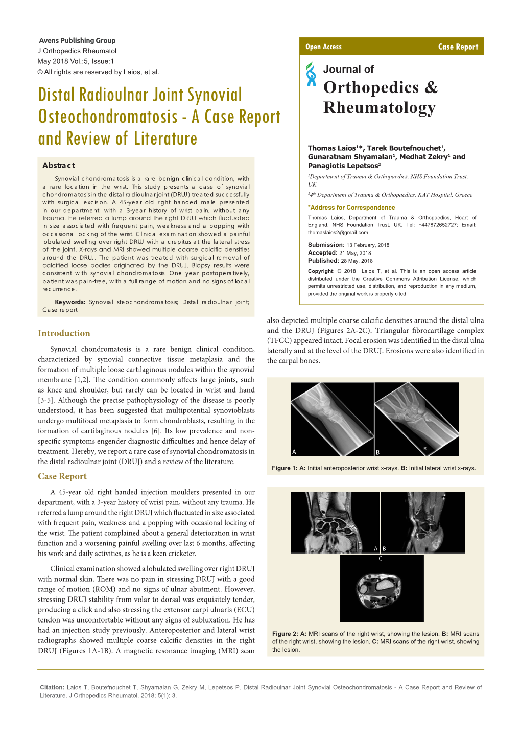 Distal Radioulnar Joint Synovial Osteochondromatosis - a Case Report and Review of Literature