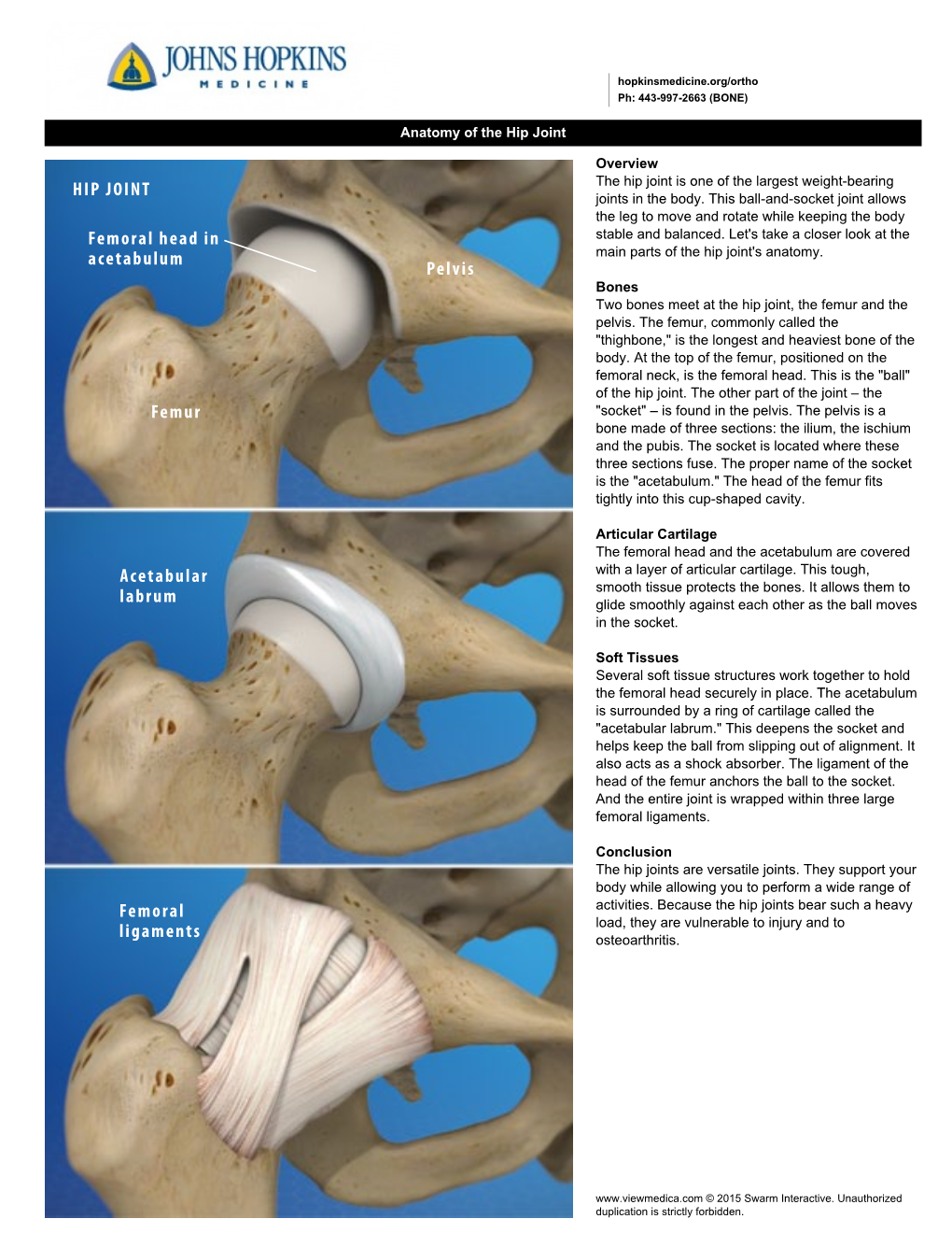 Femur Pelvis HIP JOINT Femoral Head in Acetabulum Acetabular