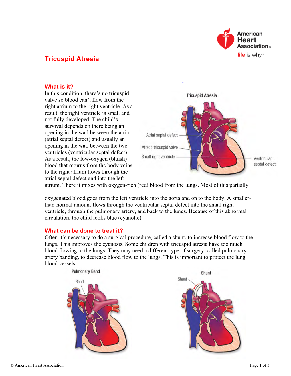 Tricuspid Atresia