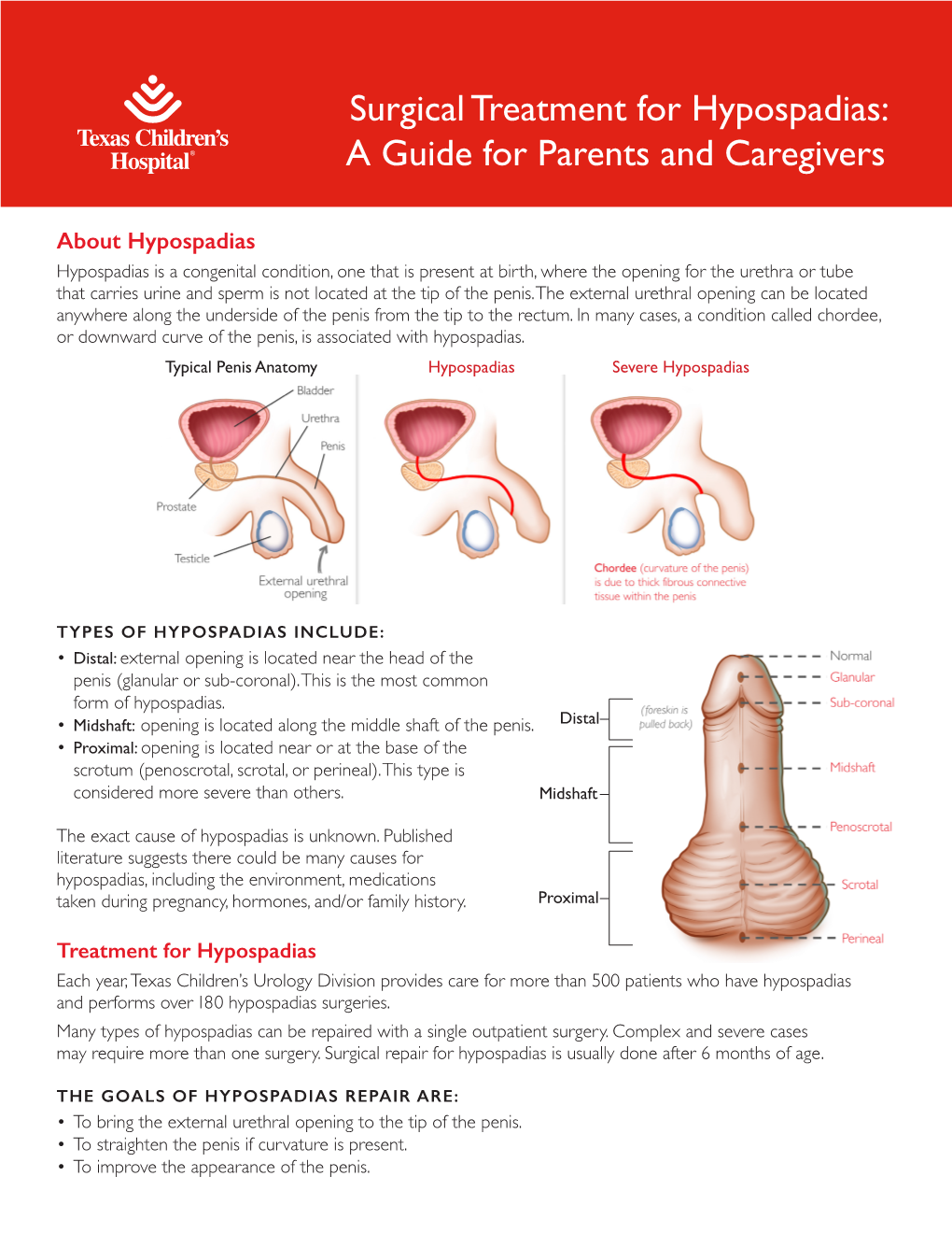 Surgical Treatment for Hypospadias: a Guide for Parents and Caregivers