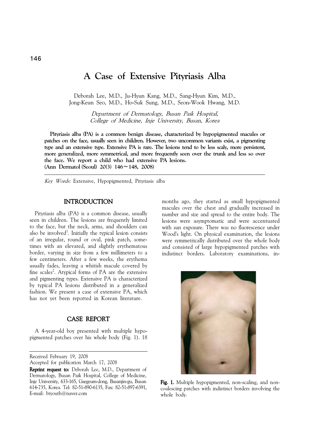 A Case of Extensive Pityriasis Alba