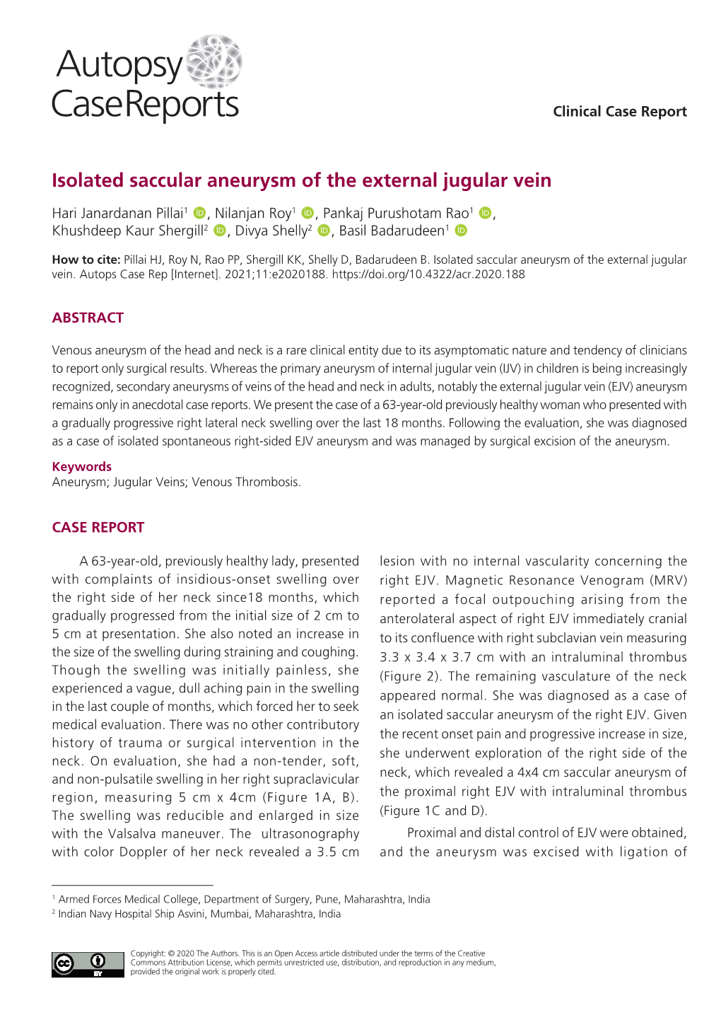 Isolated Saccular Aneurysm of the External Jugular Vein