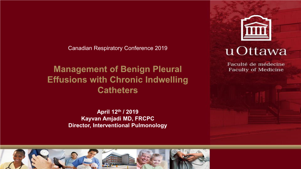 Management of Benign Pleural Effusions with Chronic Indwelling Catheters