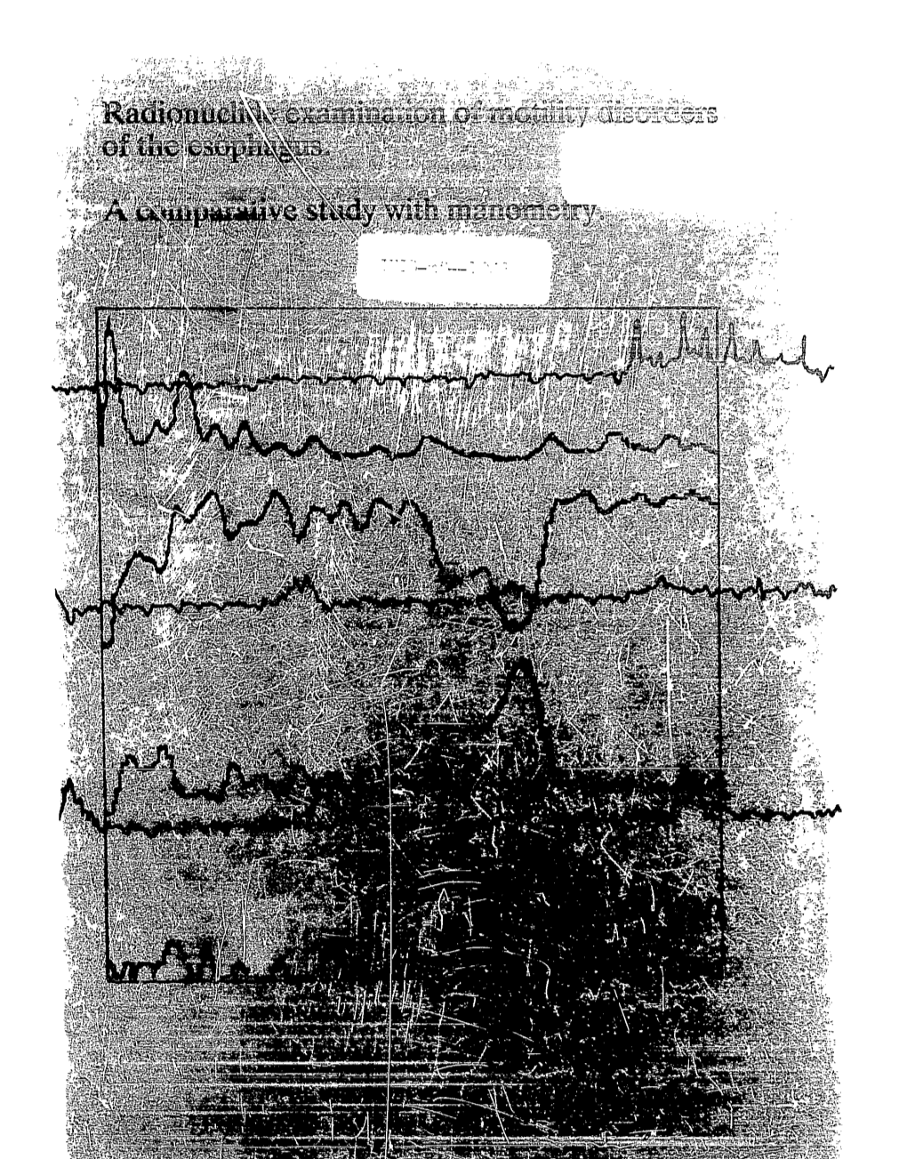 Radionuclide Examination of Motility Disorders of the Esophagus