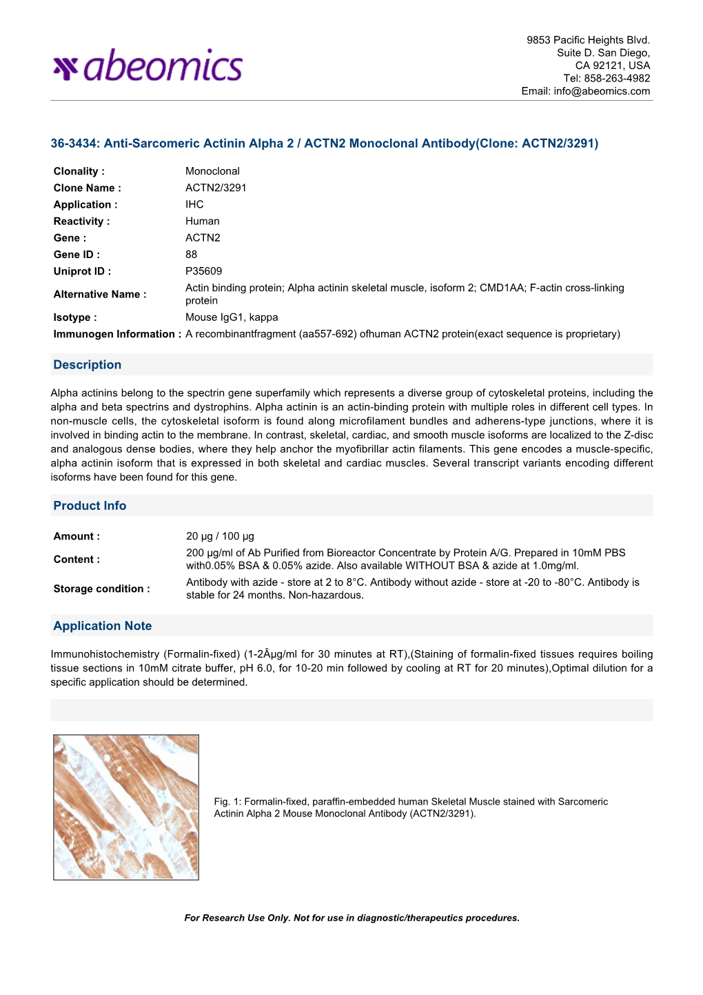 Anti-Sarcomeric Actinin Alpha 2 / ACTN2 Monoclonal Antibody(Clone: ACTN2/3291)