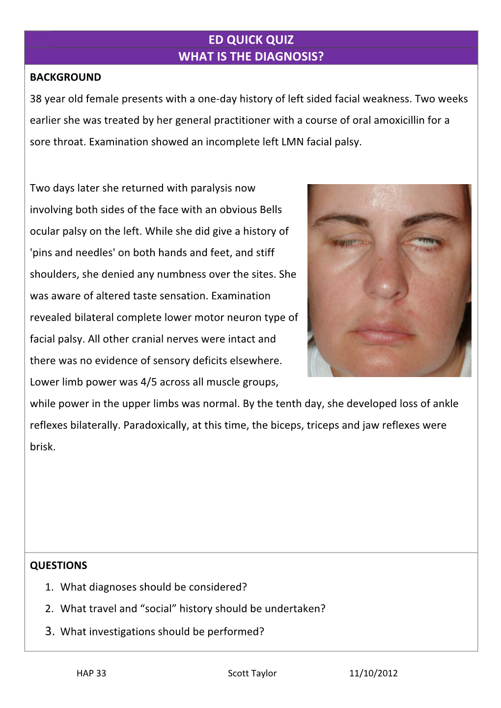 ED QUICK QUIZ WHAT IS the DIAGNOSIS? BACKGROUND 38 Year Old Female Presents with a One-Day History of Left Sided Facial Weakness