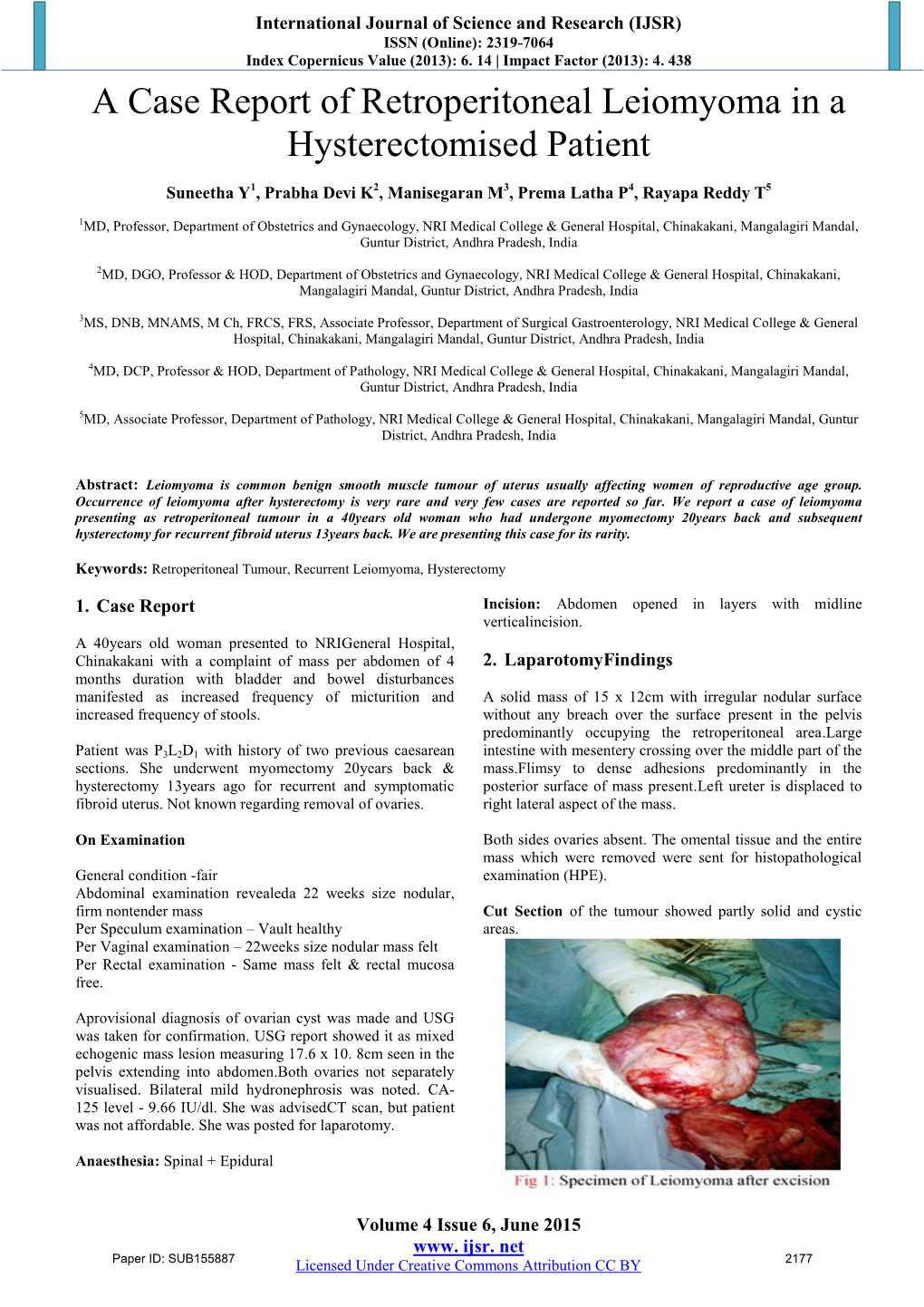 A Case Report of Retroperitoneal Leiomyoma in a Hysterectomised Patient