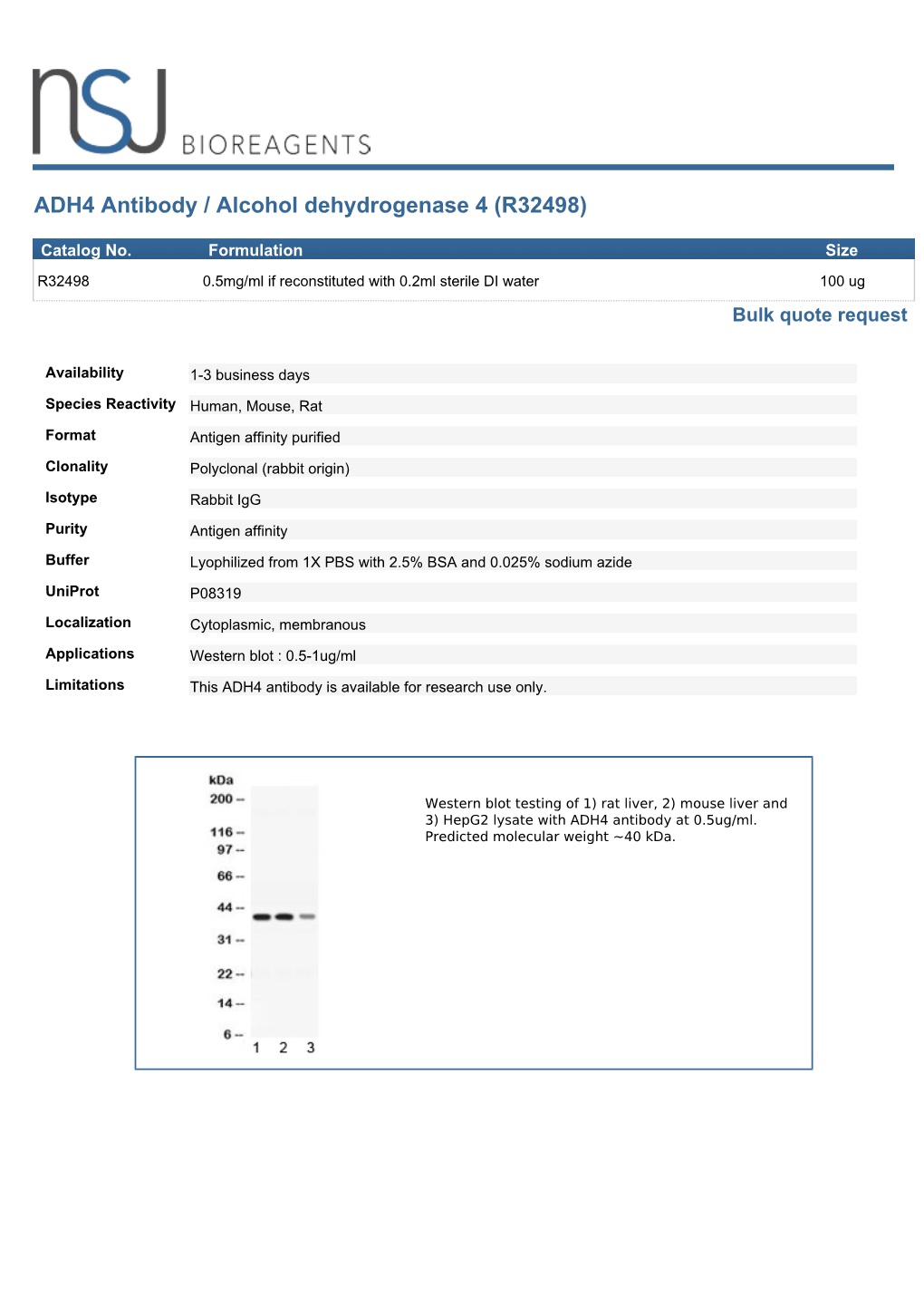 ADH4 Antibody / Alcohol Dehydrogenase 4 (R32498)